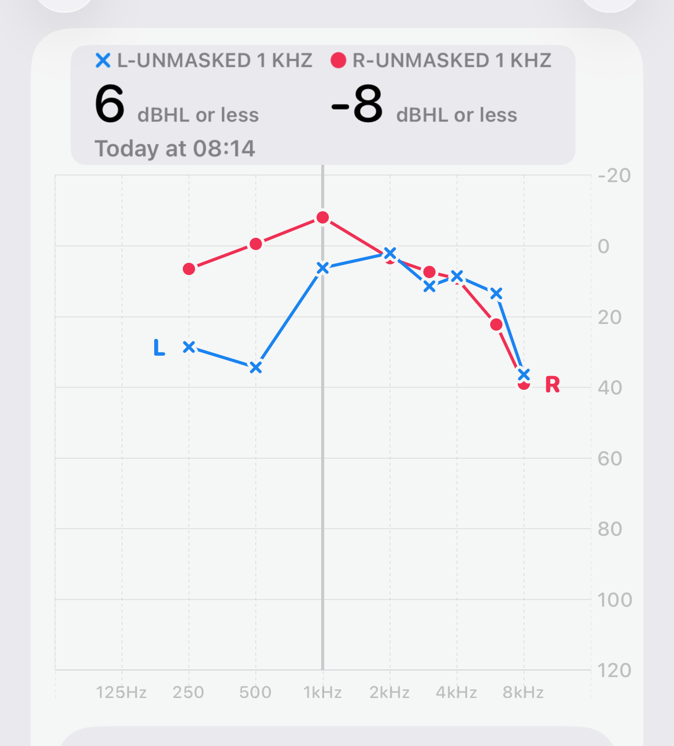 Apple Hearing Test result from 23 July 2026 showing matching left-ear low-frequency loss: 29 dB at 250 Hz and 34 dB at 500 Hz, recovering to near-normal at 1 kHz